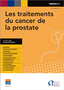 Les traitements du cancer de la prostate